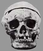 Beethoven's Skull